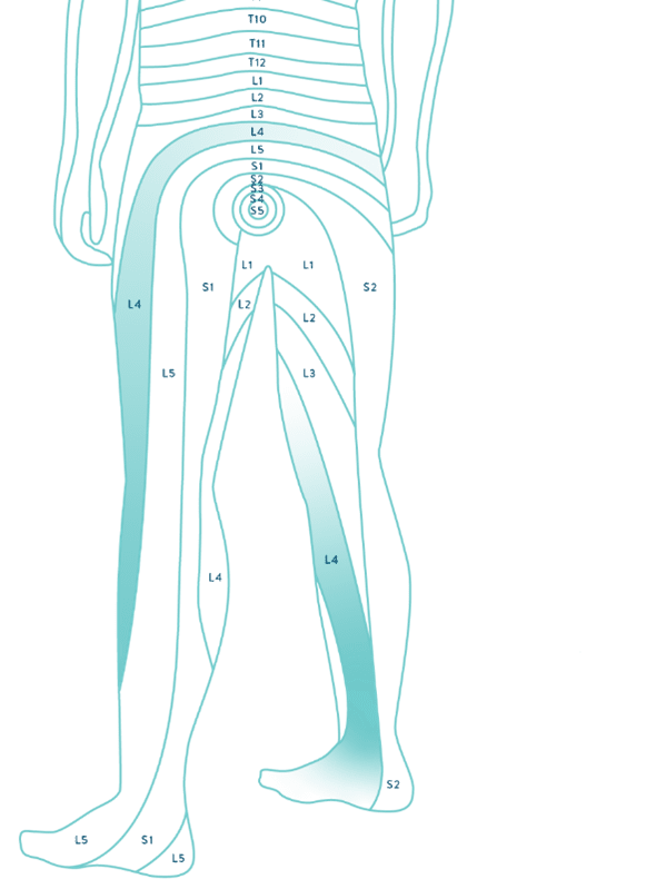 DRG Body Graphic