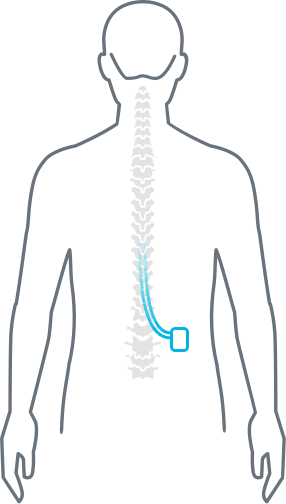 Human Diagram SCS